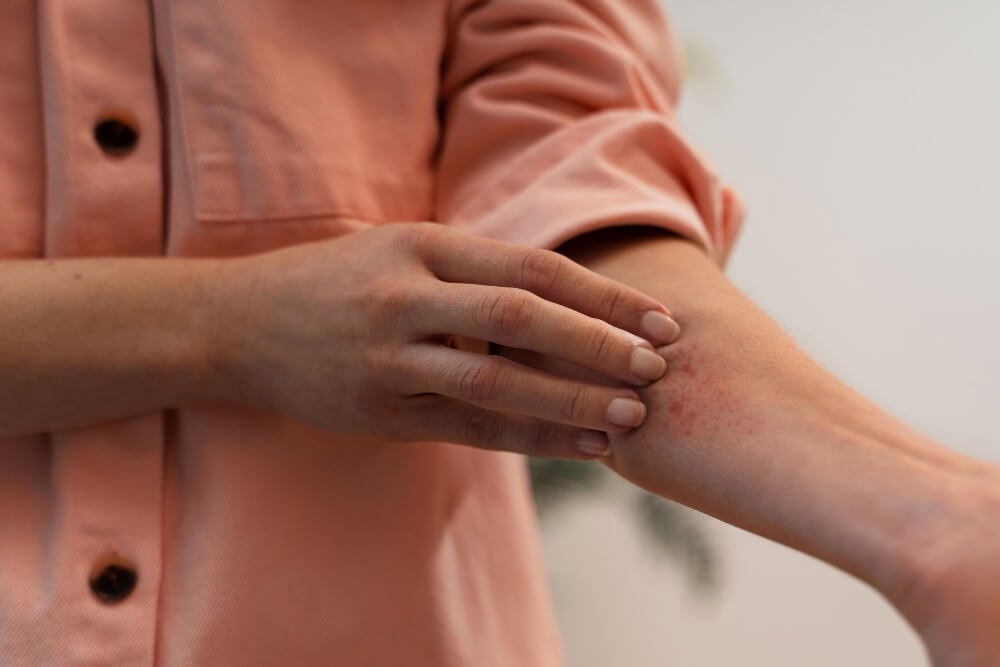 Understanding Skin Allergies: Causes, Symptoms, and Treatments